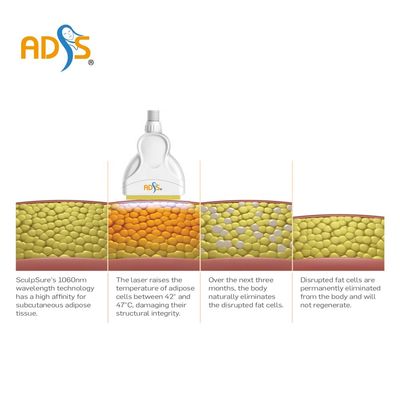 1060nm Cryolipolysis স্লিমিং মেশিন 4 হ্যান্ডেল ডায়োড লেজার স্লিমিং মেশিন